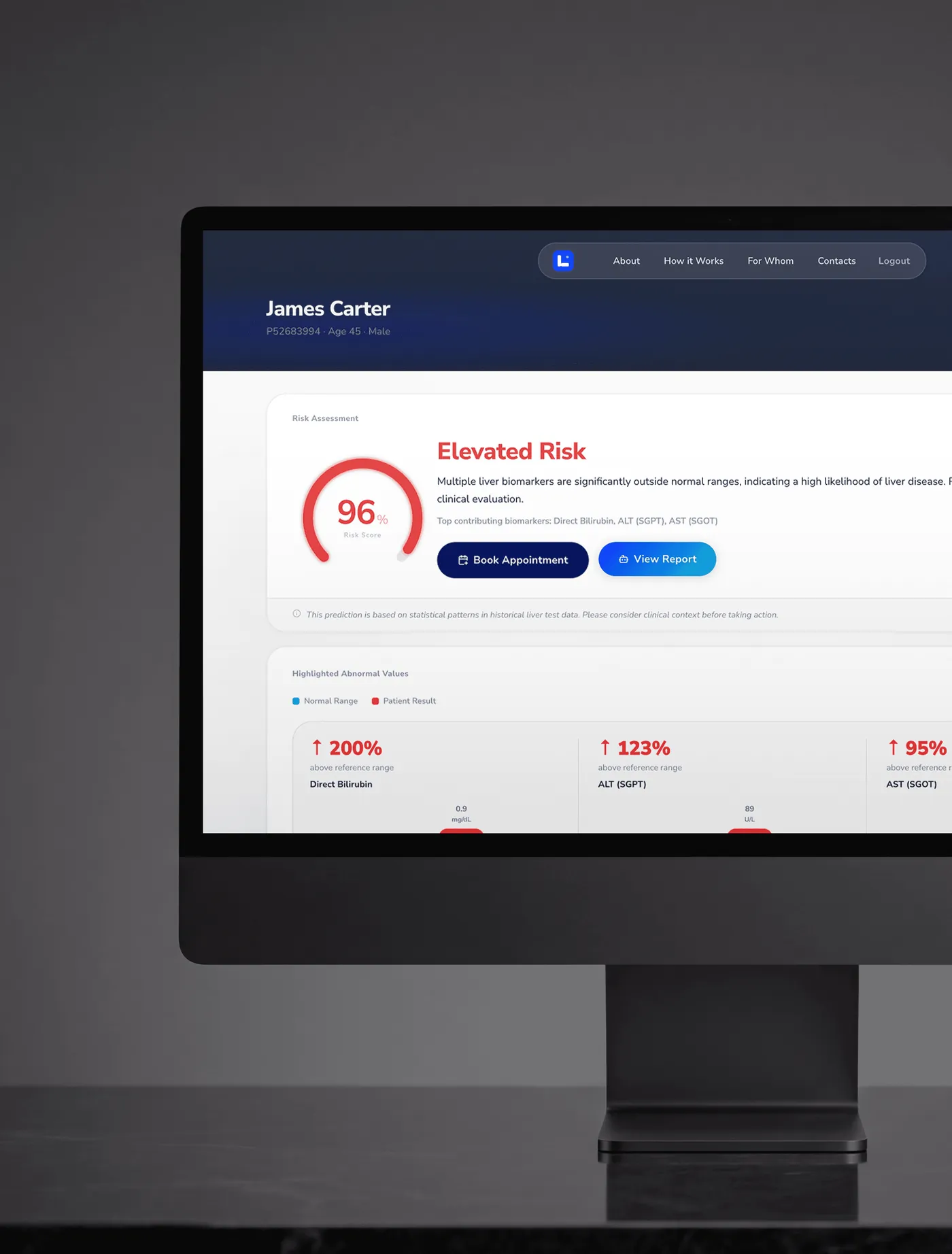 Liver disease risk dashboard on a desktop monitor