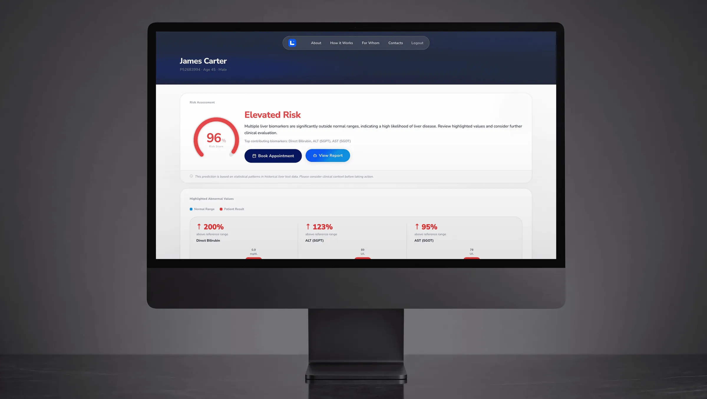 Livr risk assessment dashboard on a desktop monitor